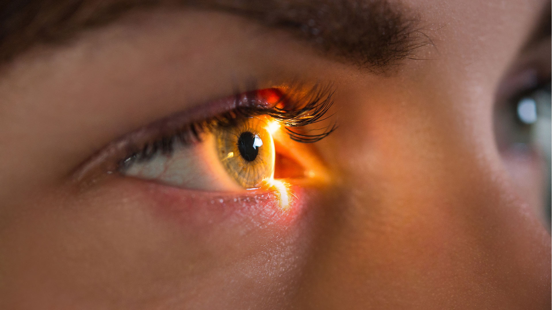 Novai EIS Single Company